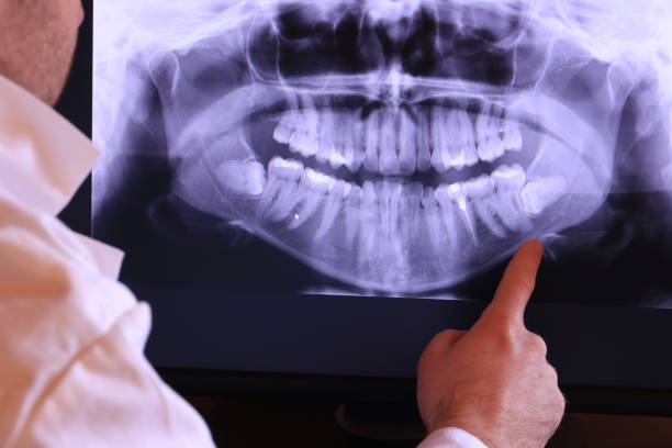 Best Emergency Root Canal Treatment in Vla Park, IL