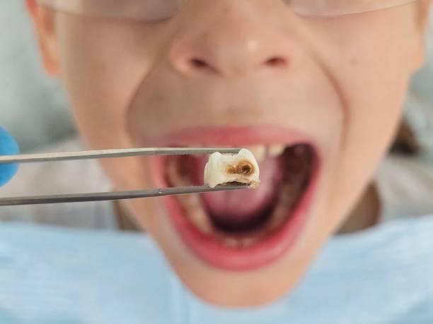Best Weekend Emergency Dentist in Vla Park, IL